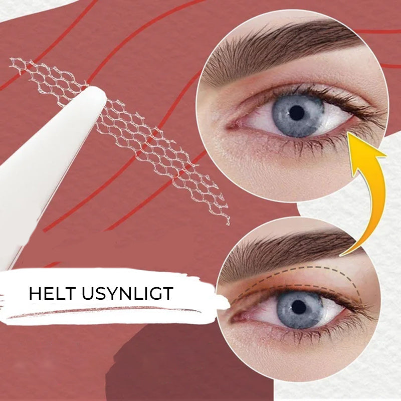 Näkymättömät silmäluomien kohotustarrat