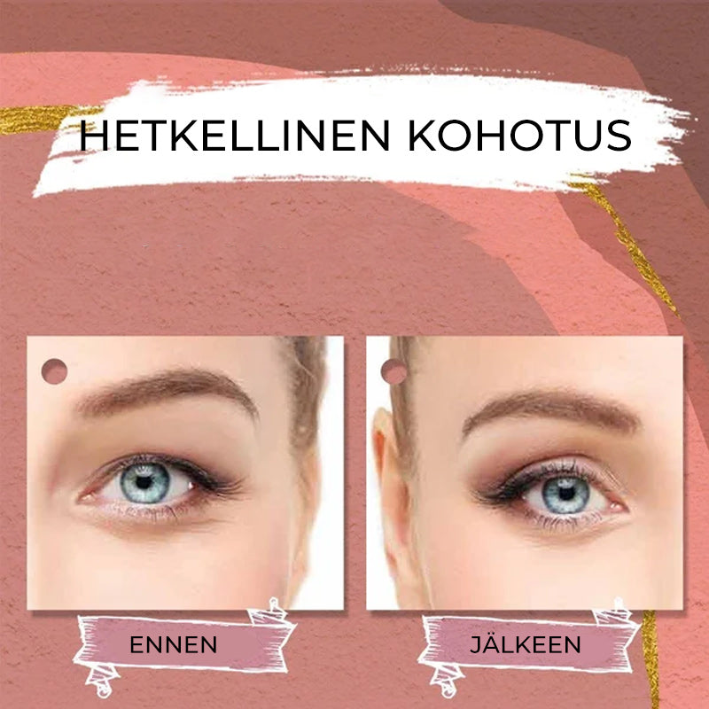 Näkymättömät silmäluomien kohotustarrat