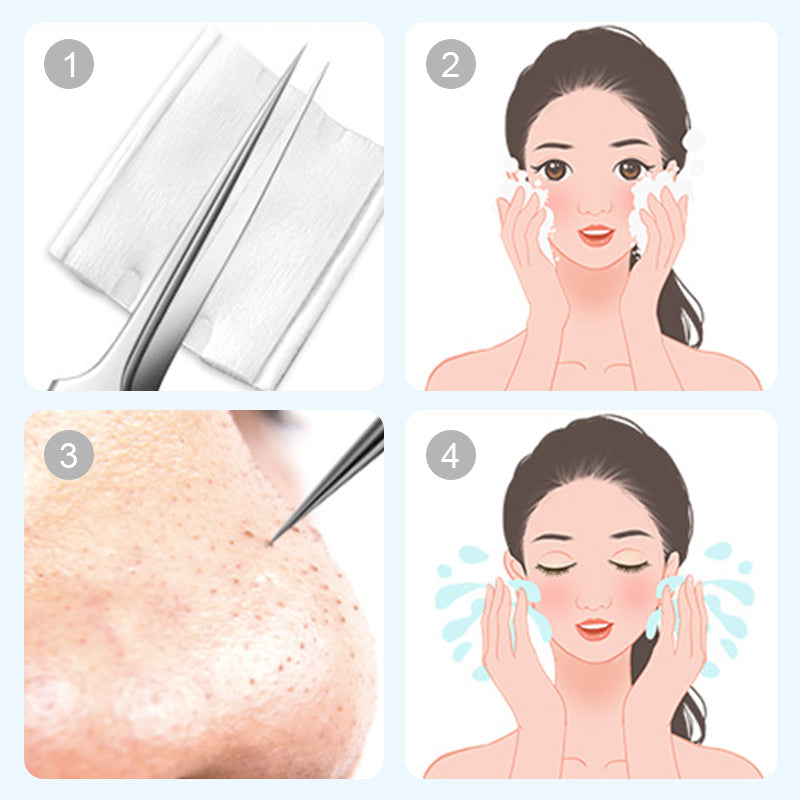 Ruostumaton teräs Blackhead Remover Tool Kit
