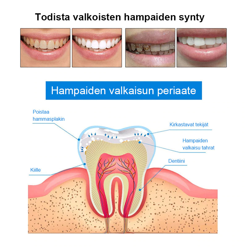 Hampaidenvalkaisukynät